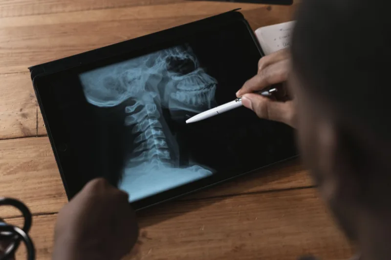 Tablet ekranındaki yandan çekilmiş boyun röntgenini kalemle gösteren kişinin elleri